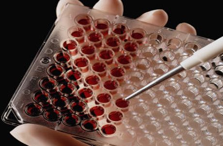 Transmisi heteroseksual HIV: penemuan baru