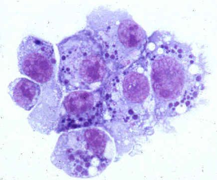 Patogen anaplasmosis manusia (keluarga Anaplasmataceae)