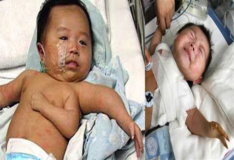 Budak lelaki dengan tiga lengan
