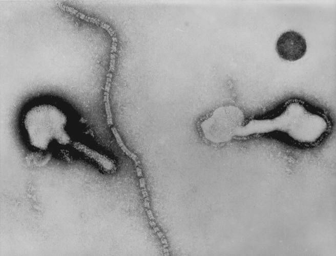 Virus Parainfluenza