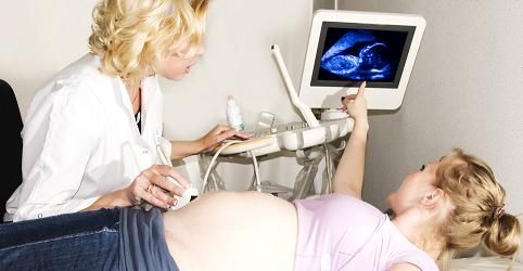 Wanita semakin membuat keputusan untuk melakukan bahagian cesarean